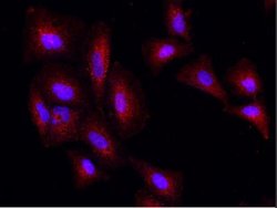 Phosphoserine phosphatase Rabbit anti-Human, Clone: 1, Novus Biologicals