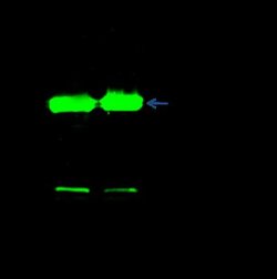 Phosphoserine phosphatase Rabbit anti-Human, Clone: 1, Novus Biologicals