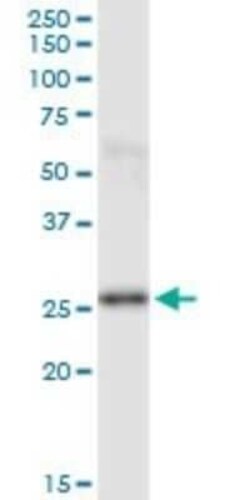 Phosphoserine phosphatase Antibody (3A5), Novus Biologicals 0.05 mg | Buy Online | Novus Biologicals | Fisher Scientific