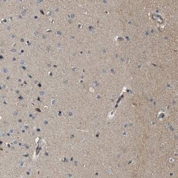 Piccolo Antibody, Novus Biologicals 0.1 mL | Buy Online | Novus Biologicals | Fisher Scientific