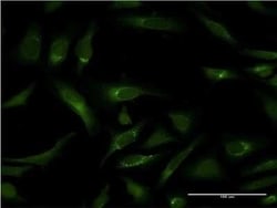 Pipecolic acid oxidase Antibody (3D1), Novus Biologicals 0.1 mg, Unconjugated:Antibodies,