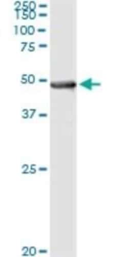 Pipecolic acid oxidase Antibody (3D1), Novus Biologicals 0.1 mg, Unconjugated:Antibodies,