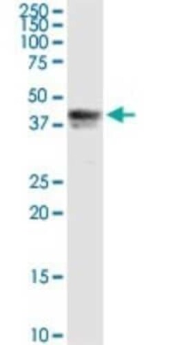 Pipecolic acid oxidase Antibody, Novus Biologicals 0.1 mg | Buy Online | Novus Biologicals | Fisher Scientific