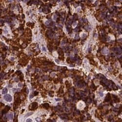Placental Lactogen/CSH1 Antibody, Novus Biologicals 100&mu;L; Unlabeled:Antibodies,