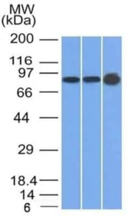 Plakophilin 1 Antibody (10B2), Novus Biologicals:Antibodies:Primary Antibodies