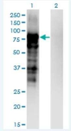Plakophilin-3 Antibody (6E5), Novus Biologicals 100 &mu;g | Buy Online | Novus Biologicals | Fisher Scientific