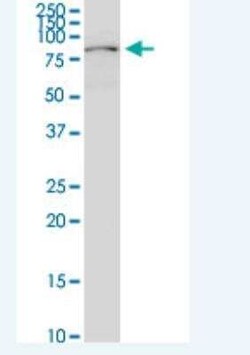 Plakophilin-3 Antibody (6E5), Novus Biologicals 100 &mu;g | Buy Online | Novus Biologicals | Fisher Scientific
