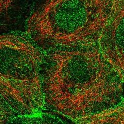 Plakophilin-3 Antibody, Novus Biologicals 25 &mu;L, Unconjugated:Antibodies,