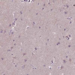 Plakophilin-3 Antibody, Novus Biologicals 25 &mu;L, Unconjugated:Antibodies,