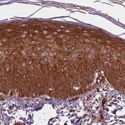 Plakophilin-3 Antibody, Novus Biologicals 25 &mu;L, Unconjugated:Antibodies,