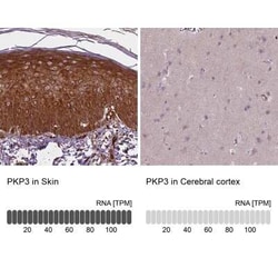 Plakophilin-3 Antibody, Novus Biologicals 25 &mu;L, Unconjugated:Antibodies,