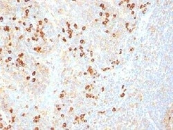Plasma Cell Marker Antibody (SPM310), Novus Biologicals 0.02 mg; Unconjugated:Antibodies