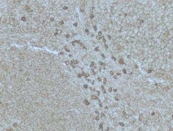 Plasma Cell Marker Antibody (SPM310), Novus Biologicals 0.02 mg; Unconjugated:Antibodies