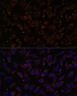 Plasmolipin Antibody - Azide and BSA Free, Novus Biologicals 0.02 mL; Unconjugated:Antibodies,