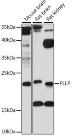 Plasmolipin Antibody - Azide and BSA Free, Novus Biologicals 0.02 mL; Unconjugated:Antibodies,