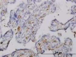 Pleckstrin Antibody (6E3), Novus Biologicals 0.1 mg | Buy Online | Novus Biologicals | Fisher Scientific