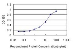 Pleckstrin Antibody (6E3), Novus Biologicals 0.1 mg | Buy Online | Novus Biologicals | Fisher Scientific