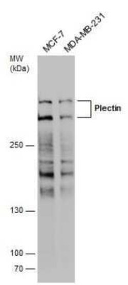 Plectin Antibody, Novus Biologicals 100 &mu;g | Buy Online | Novus Biologicals | Fisher Scientific