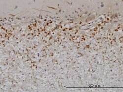 Pleiotrophin/PTN Antibody (1E7), Novus Biologicals 0.1 mg | Buy Online | Novus Biologicals | Fisher Scientific