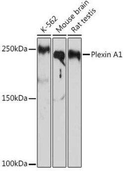 Plexin A1 Rabbit anti-Human, Mouse, Rat, Clone: 2A5Z6, Novus Biologicals 100 &mu;g | Buy Online | Novus Biologicals | Fisher Scientific