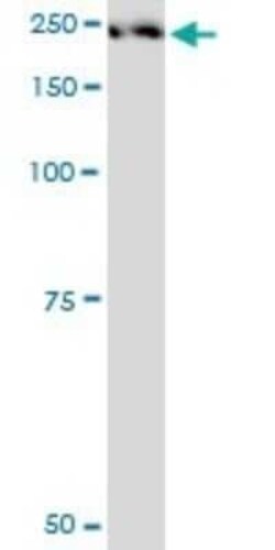 Plexin A2 Antibody (2G5), Novus Biologicals 0.1 mg | Buy Online | Novus Biologicals | Fisher Scientific