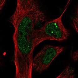 Plxdc2 Antibody, Novus Biologicals 0.1 mL | Buy Online | Novus Biologicals | Fisher Scientific