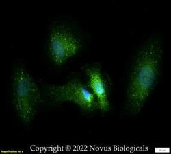 Podocin/NPHS2 Antibody, Novus Biologicals 0.1 mg; Unconjugated:Antibodies,