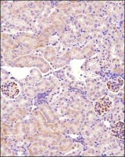 Podocin/NPHS2 Antibody, Novus Biologicals 0.1 mg; Unconjugated:Antibodies,