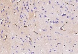 Podoplanin Rabbit anti-Mouse, Clone: 66, Novus Biologicals:Antibodies:Primary