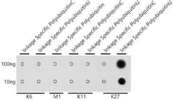 Poly-Ubiquitin Antibody - K29 Linkage - Azide and BSA Free, Novus Biologicals