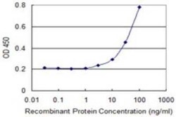 Polycystin 2 Antibody (1G3), Novus Biologicals 0.1 mg | Buy Online | Novus Biologicals | Fisher Scientific