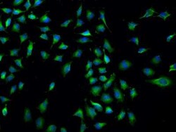 Polycystin 2 Antibody, Novus Biologicals 50 &mu;g; Unconjugated:Antibodies,