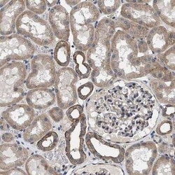 Polycystin 2 Antibody, Novus Biologicals:Antibodies:Primary Antibodies