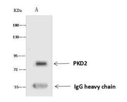 Polycystin 2 Antibody, Novus Biologicals 50 &mu;g; Unconjugated:Antibodies,