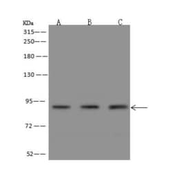 Polycystin 2 Antibody, Novus Biologicals 50 &mu;g; Unconjugated:Antibodies,