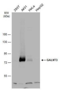 Polypeptide GalNac Transferase 3/GALNT3 Antibody, Novus Biologicals 100 &mu;g | Buy Online | Novus Biologicals | Fisher Scientific