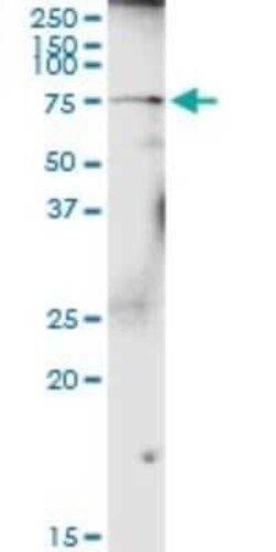 Polypeptide GalNac Transferase 4/GALNT4 Antibody, Novus Biologicals 0.1 mg | Buy Online | Novus Biologicals | Fisher Scientific