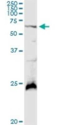 Polypeptide GalNac Transferase 4/GALNT4 Antibody, Novus Biologicals 0.1 mg | Buy Online | Novus Biologicals | Fisher Scientific