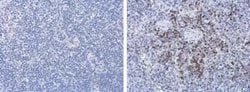 Porcine Circovirus 2 Capsid Antibody (GT863), Novus Biologicals 100 &mu;g | Buy Online | Novus Biologicals | Fisher Scientific