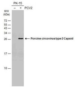 Porcine Circovirus 2 Capsid Antibody (GT972), Novus Biologicals 100 &mu;g | Buy Online | Novus Biologicals | Fisher Scientific