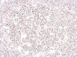 Porcine Circovirus 2 Capsid Antibody, Novus Biologicals 100 &mu;g | Buy Online | Novus Biologicals | Fisher Scientific