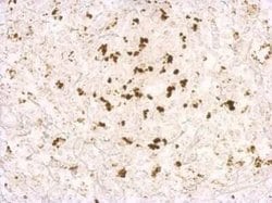Porcine Circovirus 2 Capsid Antibody, Novus Biologicals 100 &mu;g | Buy Online | Novus Biologicals | Fisher Scientific