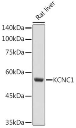 Potassium Channel Kv3.1 Rabbit anti-Human, Mouse, Rat, Polyclonal, Novus