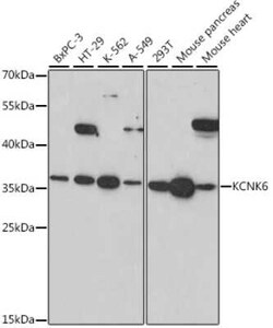 Potassium channel subfamily K member 6 Antibody - Azide and BSA Free, Novus