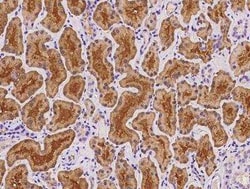 Pregnancy Zone Protein Antibody, Novus Biologicals:Antibodies:Primary Antibodies