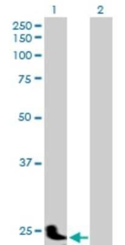 Pregnancy specific beta 1 glycoprotein 11 Antibody, Novus Biologicals 0.05 mg | Buy Online | Novus Biologicals | Fisher Scientific