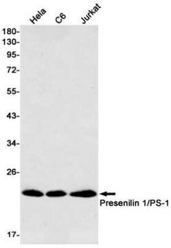 Presenilin-1 Rabbit anti-Human, Mouse, Rat, Clone: S05-4D4, Novus Biologicals 25 &mu;g | Buy Online | Novus Biologicals | Fisher Scientific