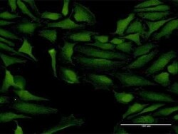 ProSAPiP1 Antibody, Novus Biologicals 50 &mu;g | Buy Online | Novus Biologicals | Fisher Scientific