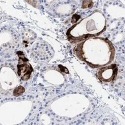 Procalcitonin Rabbit anti-Human, Polyclonal, Novus Biologicals 100 &mu;g | Buy Online | Novus Biologicals | Fisher Scientific