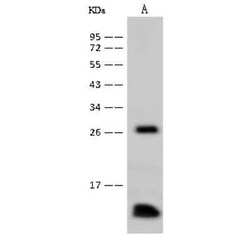 Profilin 1 Antibody, Novus Biologicals:Antibodies:Primary Antibodies